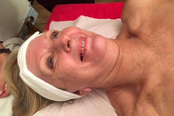 Facial or Shellac Treatment for Two at I Candy Aesthetics