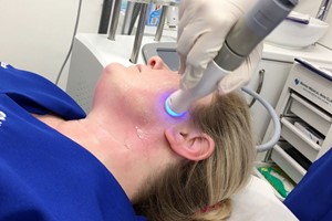 30 Minute Microdermabrasion for One at Marsh Medical Skin Clinic picture